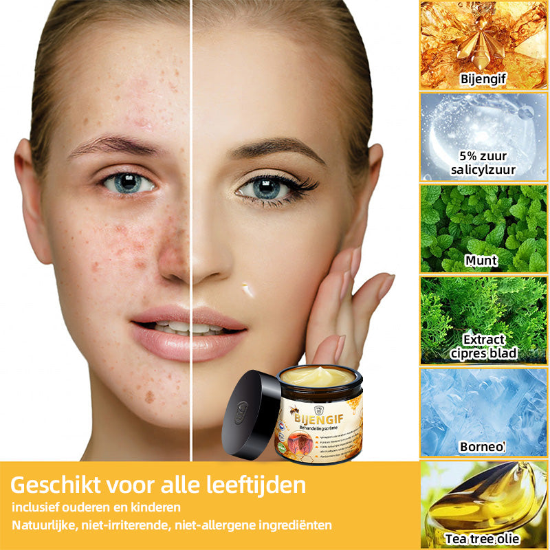 Turonu™ bijengif huidbehandelingscrème🐝 (👩‍🔬Aanbevolen door de Nederlandse Vereniging voor Dermatologie👩‍🔬).