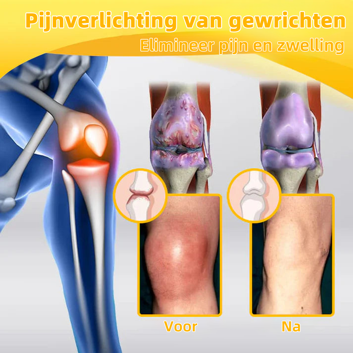 Kerstspecials FATONG® Bijengif Pijnverlichtende_Botgenezingscrème ✨✨(Speciaal voor oudere volwassenen & aanbevolen door NVOC)